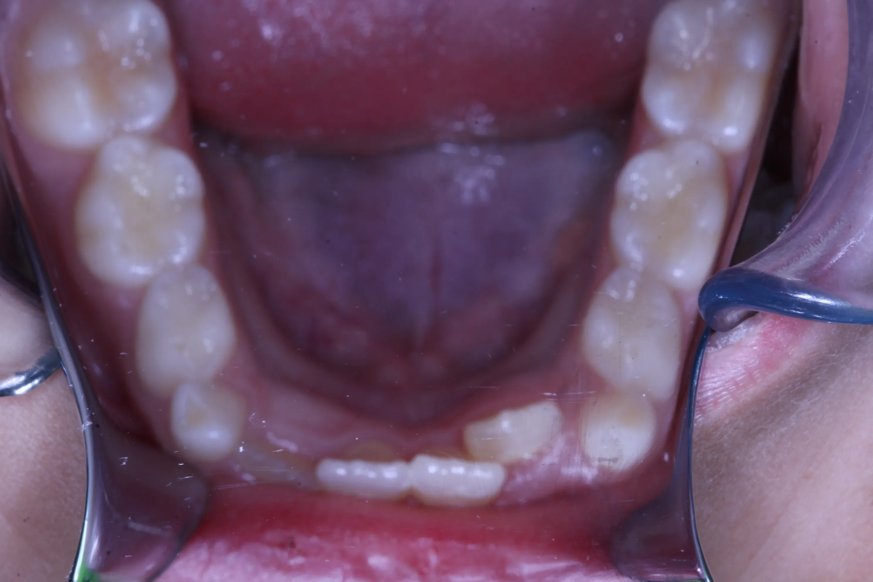 smile-gallery gallery